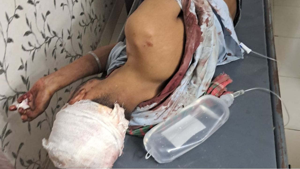 গোপালগঞ্জের সন্ত্রাসী অন্তর বাহিনির হামলায় যুবক গুরুতর আহত 