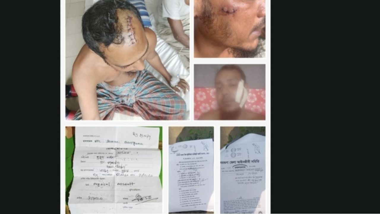 বামনায় জমি নিয়ে বিরোধে সন্ত্রাসী হামলার অভিযোগ, বিচার চান ভুক্তভোগীরা